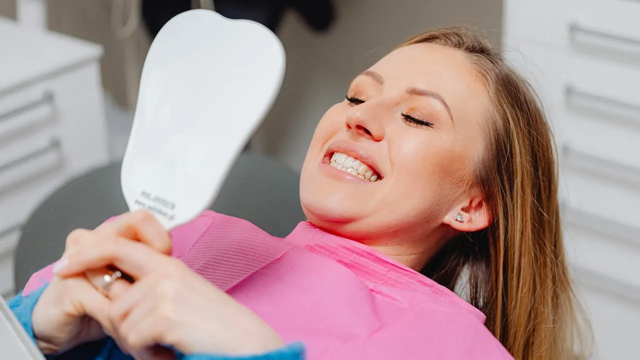 Applicazione di faccette dentali estetiche